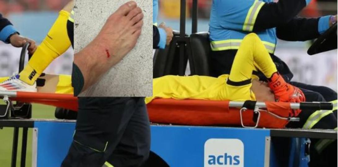 Carlos Lampe vuelve a lesionarse en el estadio donde rompió su tendón de Aquiles