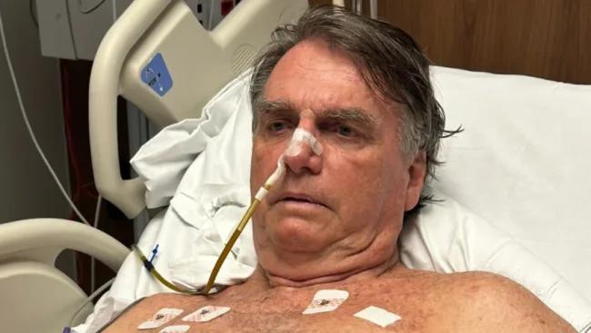 Expresidente Jair Bolsonaro es diagnosticado con cáncer de piel