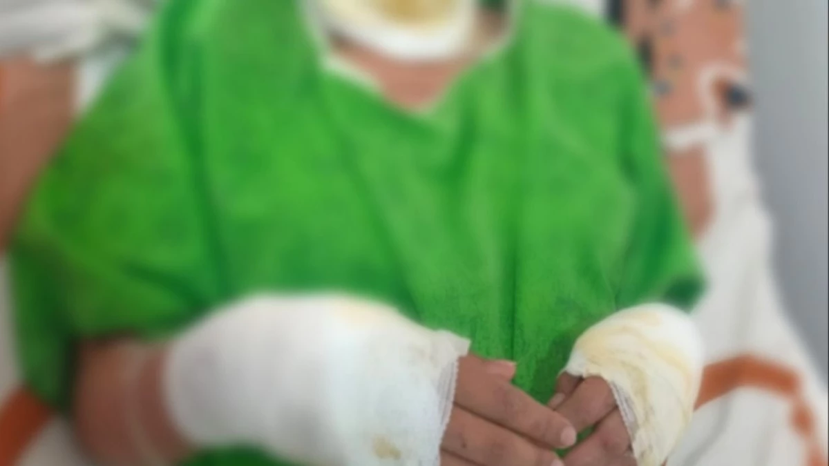 Padres son investigados por tentativa de feminicidio tras quemar a su hija en Oruro