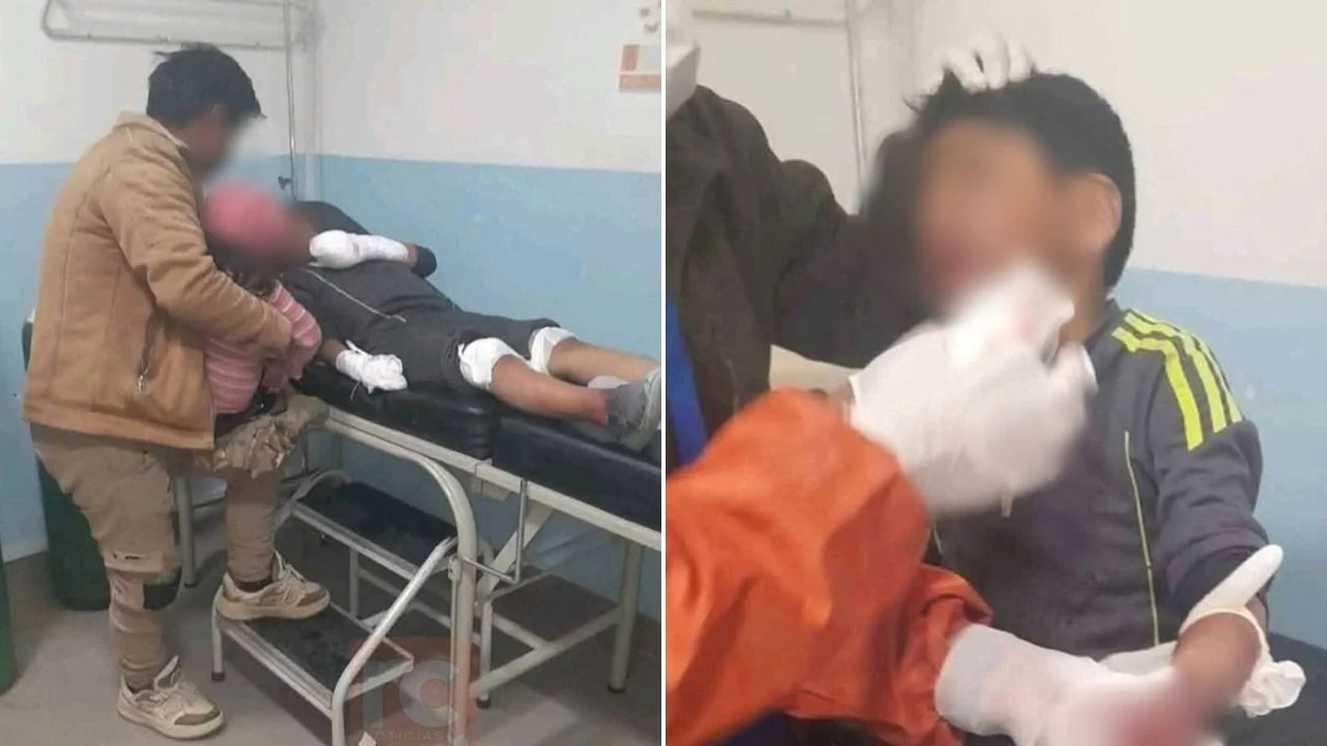 La Paz: Niño de 9 años resulta herido por explosión de petardo durante bloqueos en El Alto