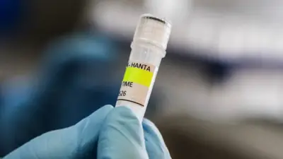 OMS reporta cinco casos confirmados de hantavirus y tres sospechosos en brote internacional