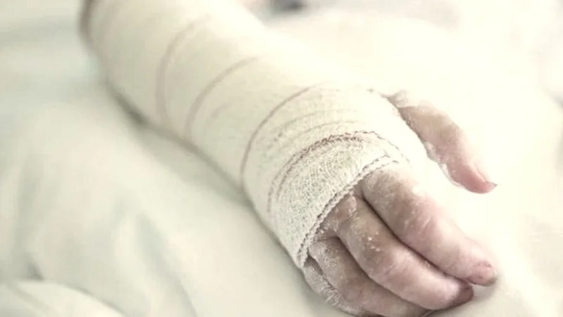 Madre de adolescente quemada pide ayuda urgente para salvar la vida de su hija
