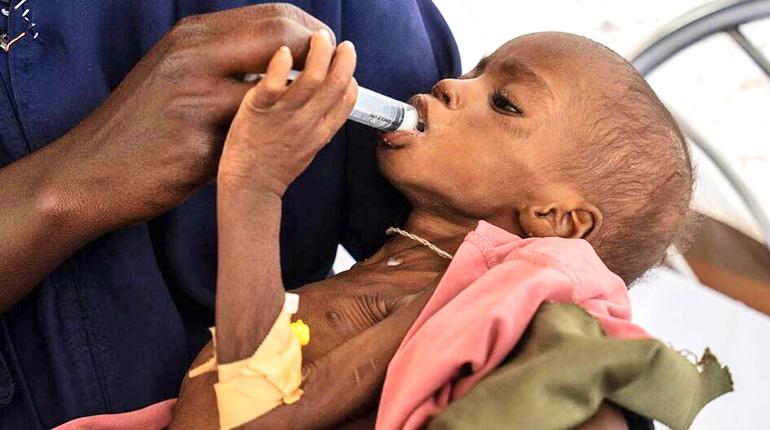 ONU: 645 millones de personas padecieron hambre en el mundo durante 2025