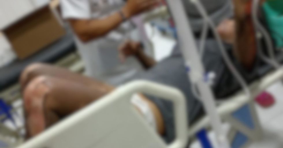 Adolescente lucha por su vida tras ser quemada presuntamente por su pareja en Cobija