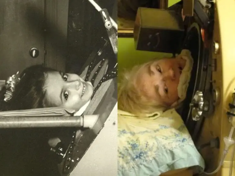 Fallece Martha Lillard, la última paciente de polio en EE.UU. que utilizaba un pulmón de acero