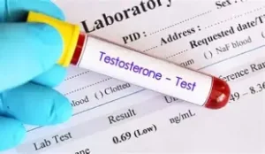 El Pentágono establece nuevos protocolos para detectar y tratar la deficiencia de testosterona en hombres