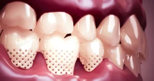 Desarrollan nanorobots que podrían ayudar a tratar la sensibilidad dental